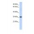 Western Blot: HSD17B14 Antibody [NBP1-57625] - This Anti-HSD17B14 antibody was used in Western Blot of Fetal Liver tissue lysate at a concentration of 1ug/ml.